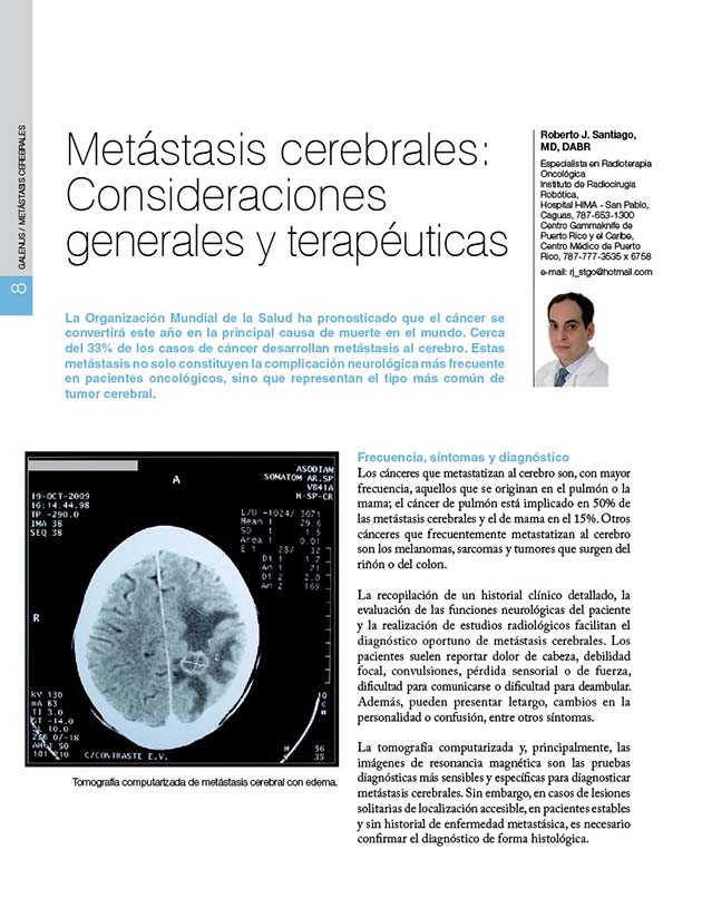 Artículos médicos: Metástasis cerebrales 