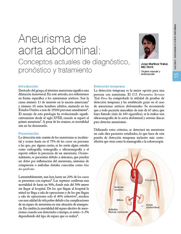 Artículos médicos: Aneurisma de aorta abdominal 