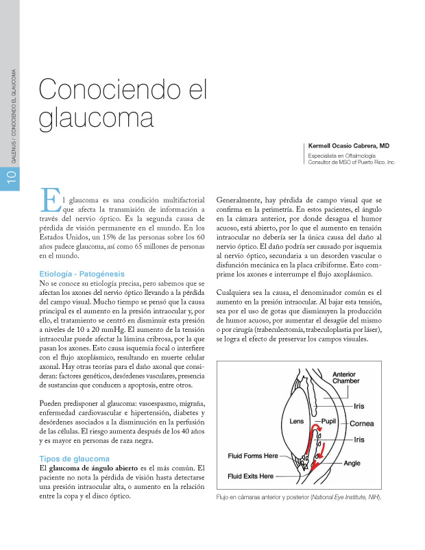 Conociendo el glaucoma 