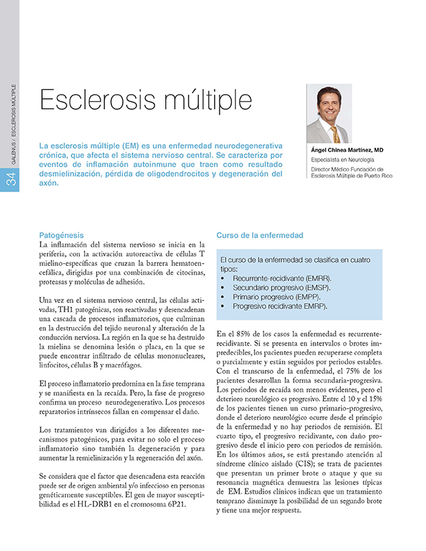 Esclerosis múltiple 