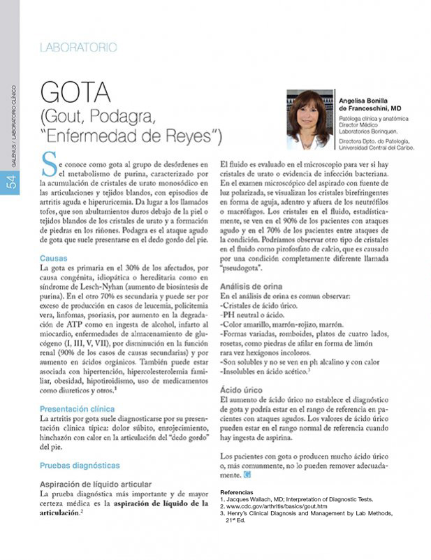 GOTA (Gout, Podagra,  “Enfermedad de Reyes”) 