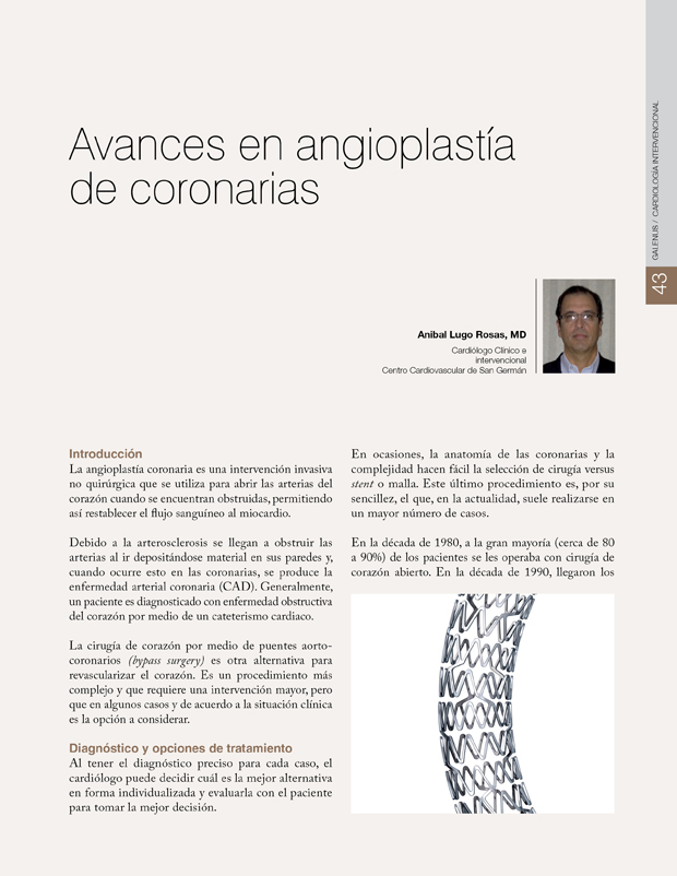 Avances en angioplastía de coronarias 