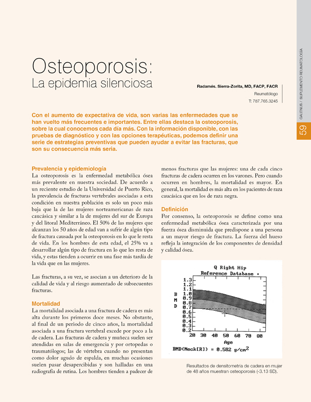 Osteoporosis: La epidemia silenciosa 
