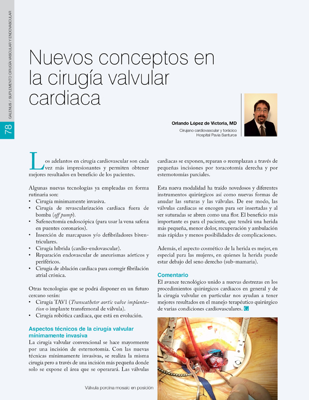Nuevos conceptos en la cirugía valvular cardiaca 
