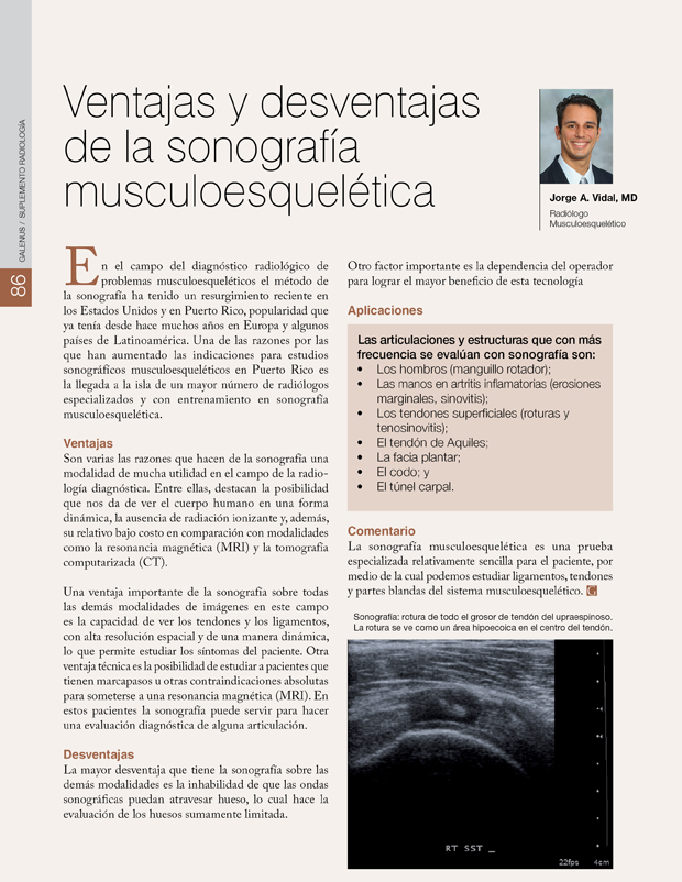 Ventajas y desventajas de la sonografía musculoesquelética 