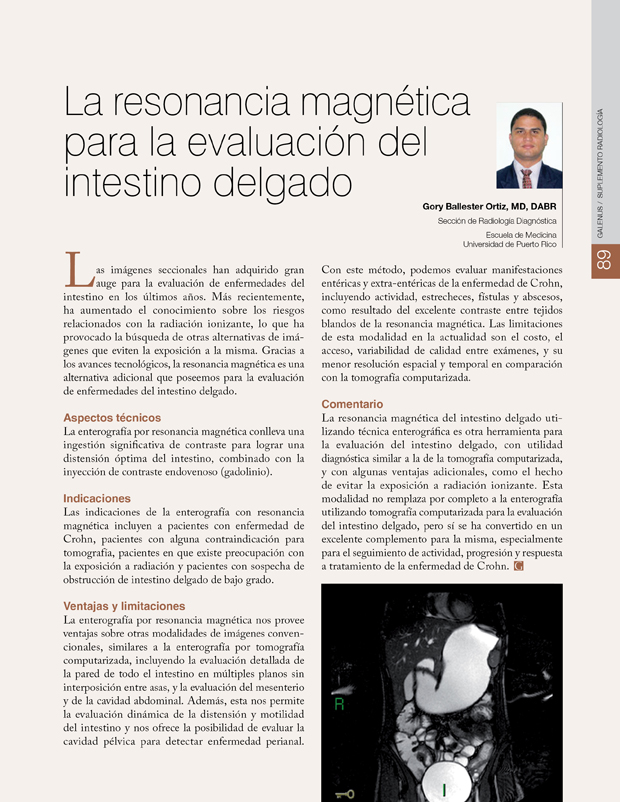 La resonancia magnética para la evaluación del intestino delgado 