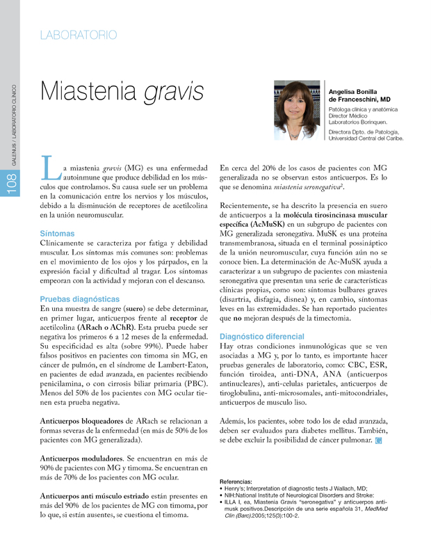 Miastenia gravis 
