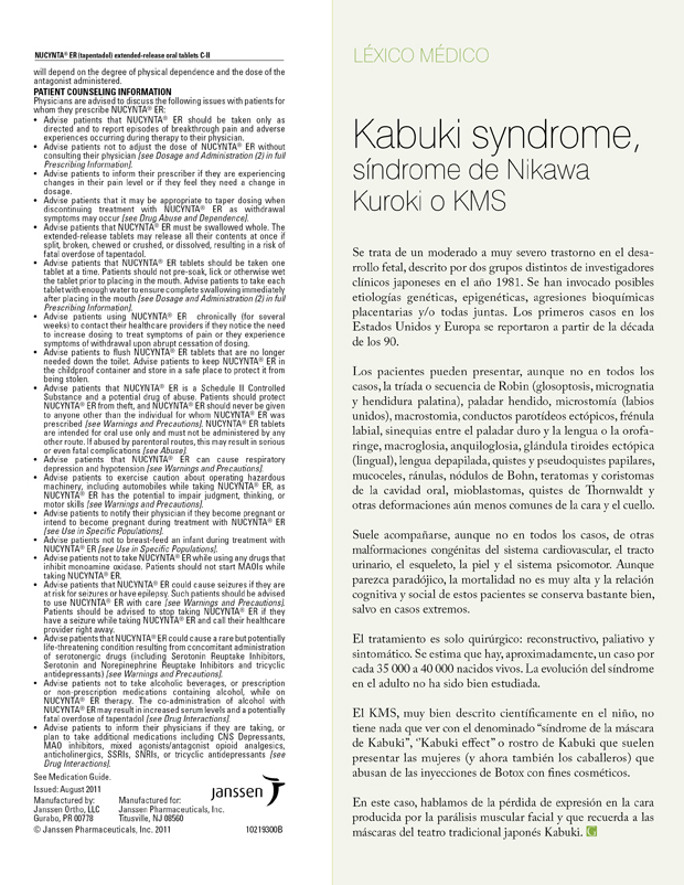 Kabuki syndrome, síndrome de Nikawa Kuroki o KMS 