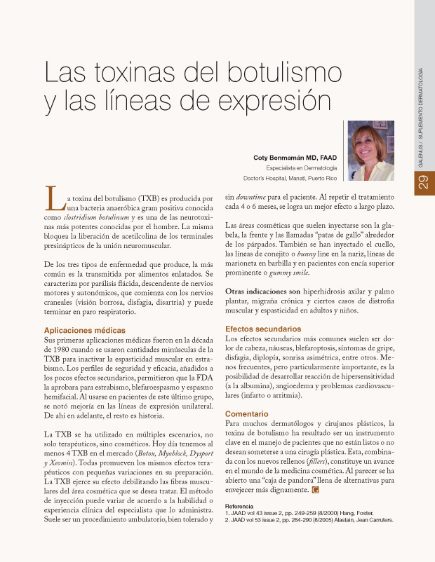 Las toxinas del botulismo y las líneas de expresión 