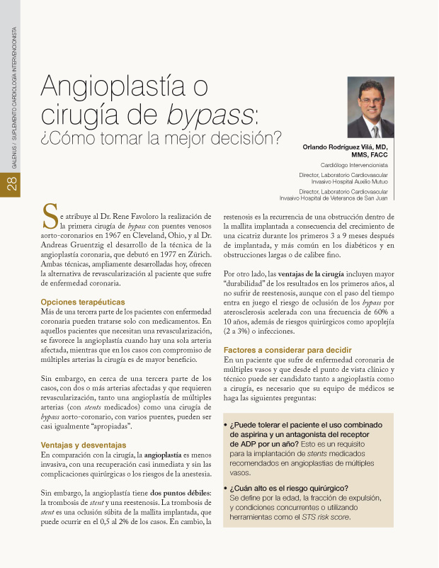 Angioplastía o cirugía de bypass: 