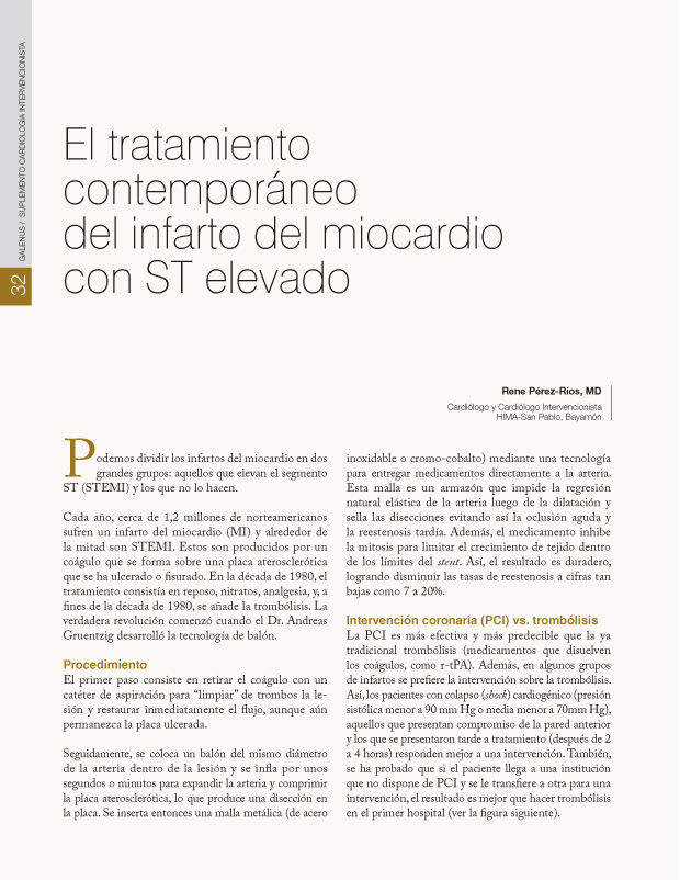 El tratamiento contemporáneo del infarto del miocardio con ST elevado 