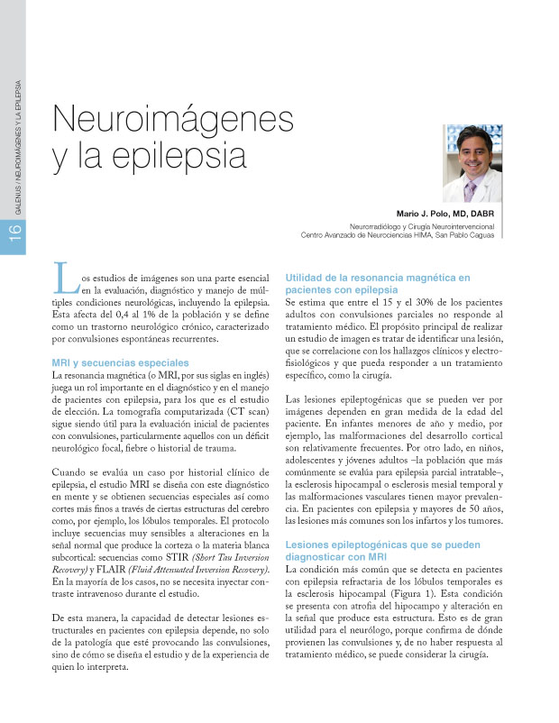 Neuroimágenes y la epilepsia 