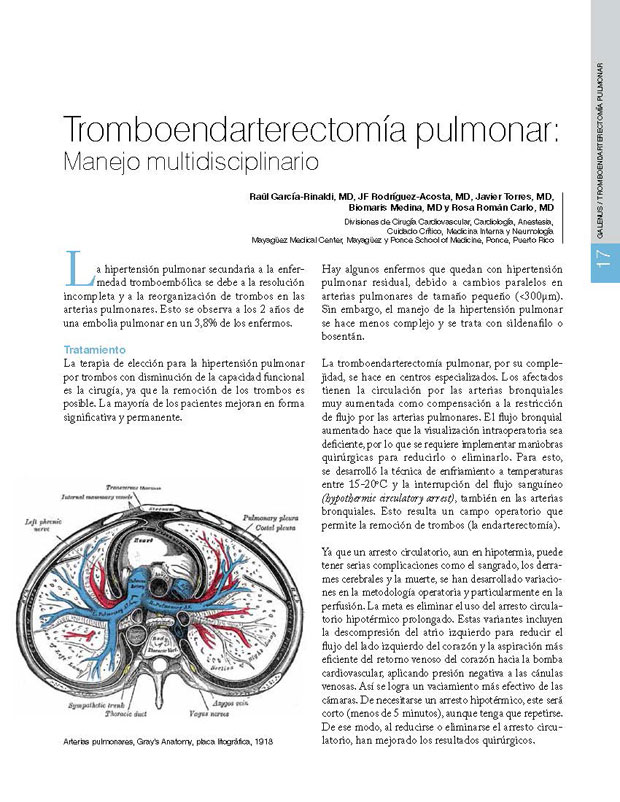 Tromboendarterectomía pulmonar: Manejo multidisciplinario 