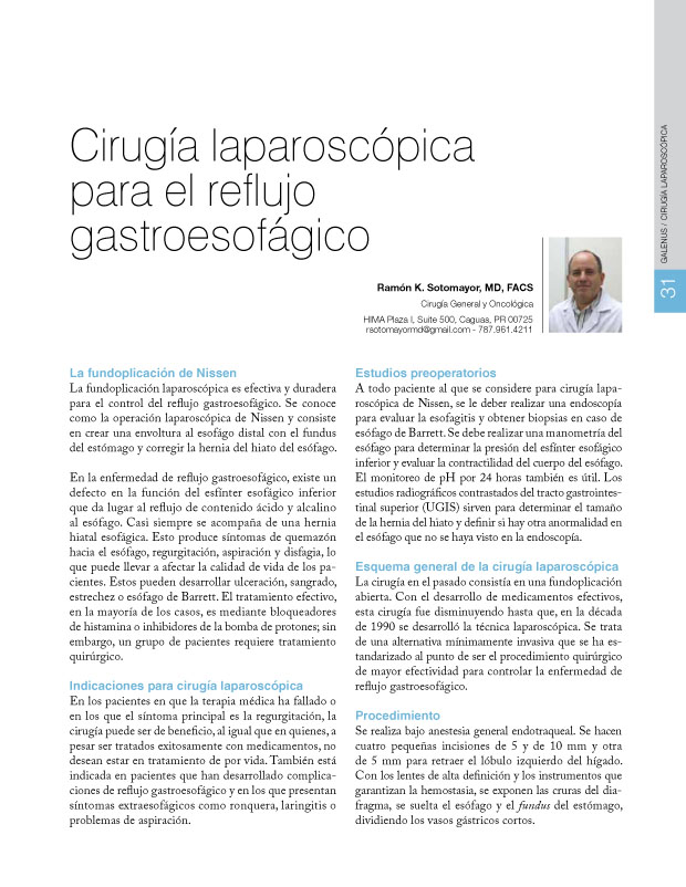 Cirugía laparoscópica para el reflujo  gastroesofágico 