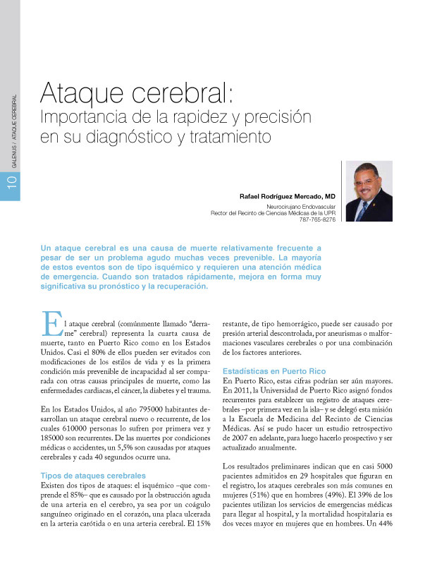 Ataque cerebral 