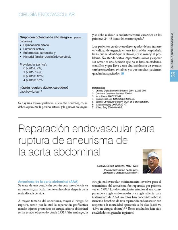 Reparación endovascular para ruptura de aneurisma de  la aorta abdominal 