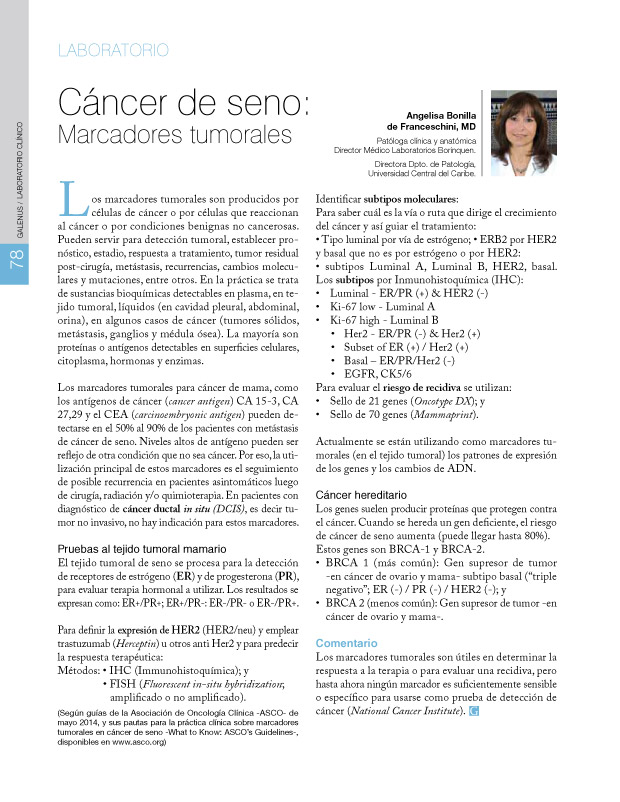 Cáncer de seno  