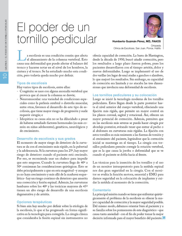 El poder de un tornillo pedicular 