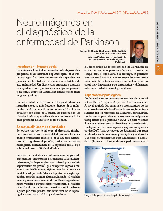 Neuroimágenes en el diagnóstico de la enfermedad de Parkinson 