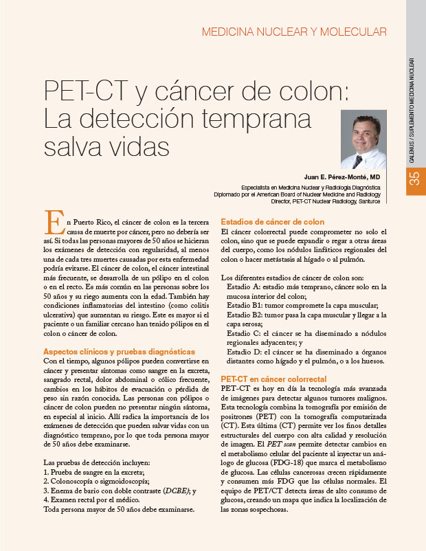 PET-CT y cáncer de colon: La detección temprana salva vidas 