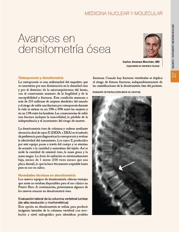 Avances en densitometría ósea 