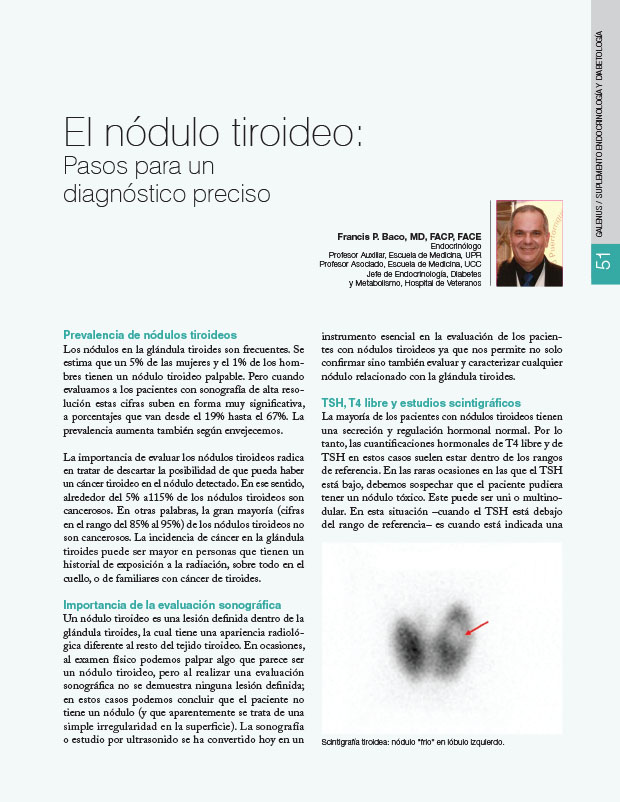 El nódulo tiroideo: Pasos para un diagnóstico preciso 