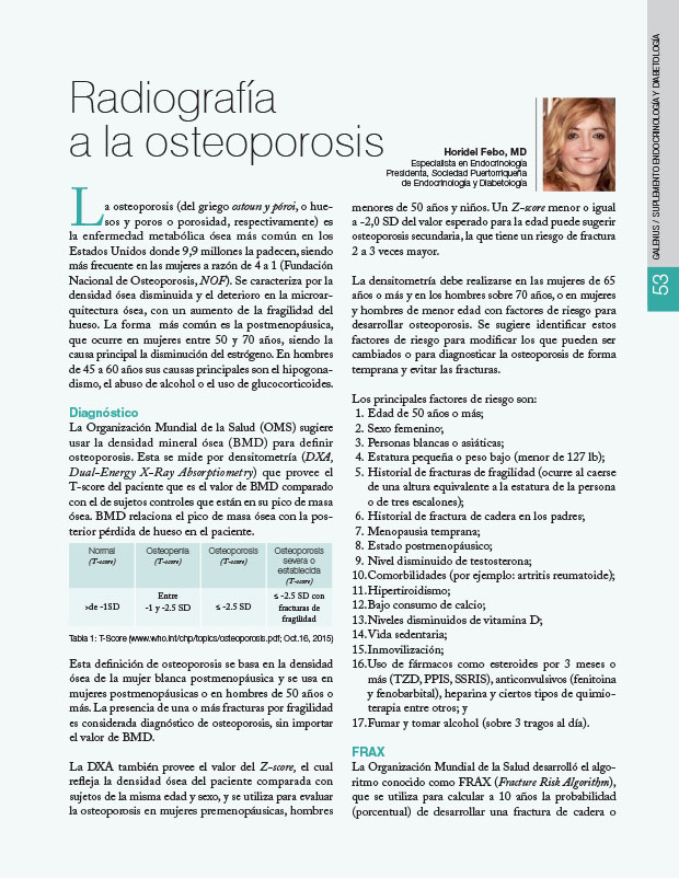 Radiografía a la osteoporosis 