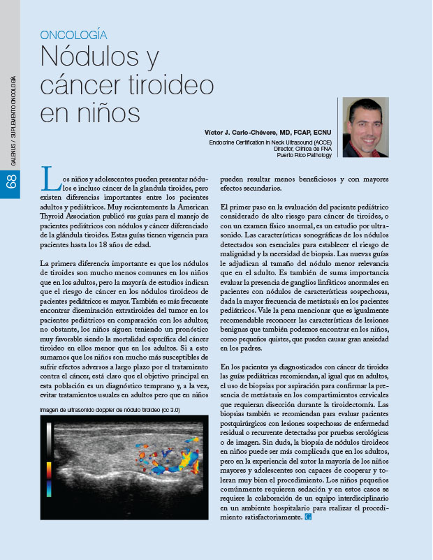 Nódulos y cáncer tiroideo en niños 