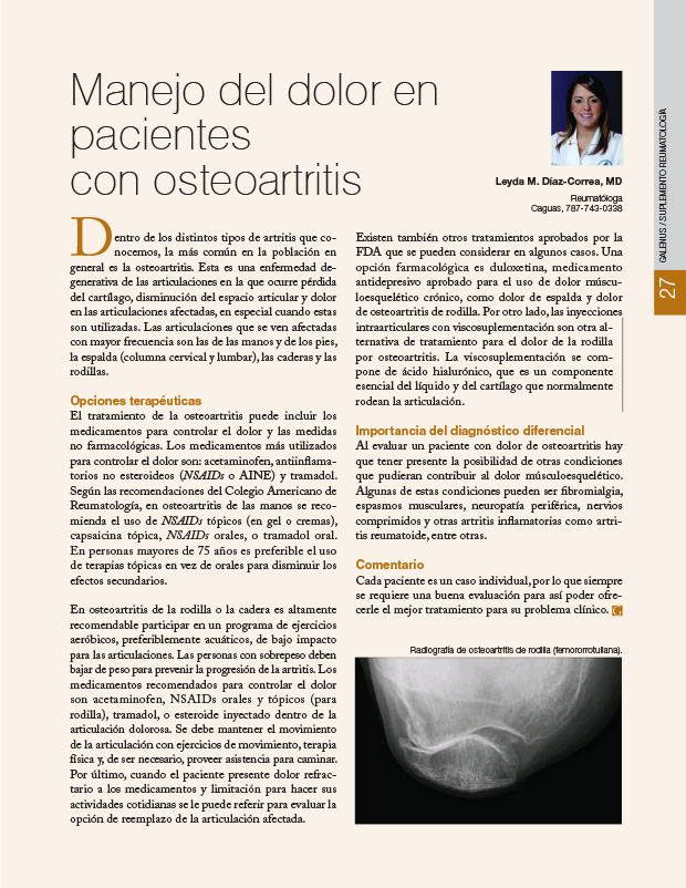 Manejo del dolor en pacientes con osteoartritis 