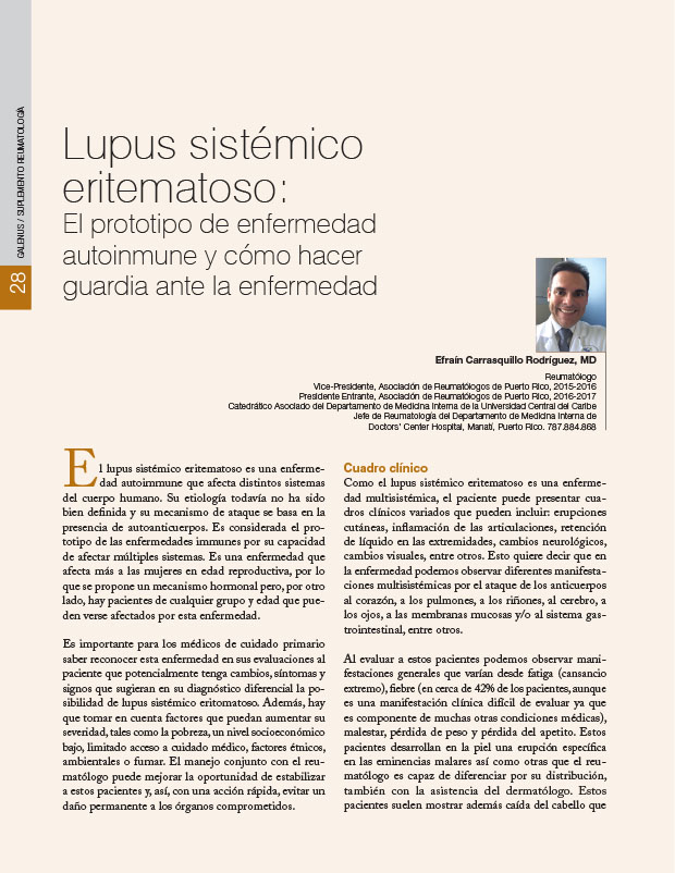 Lupus sistémico eritematoso: El prototipo de enfermedad autoinmune y cómo hacer guardia ante la enfermedad 