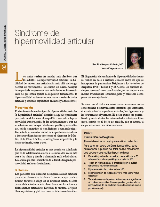 Síndrome de hipermovilidad articular 