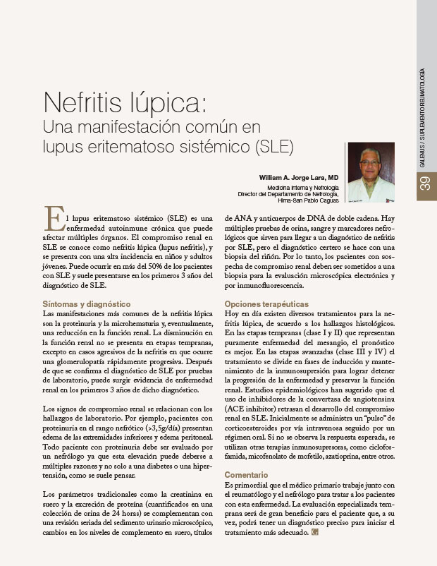 Nefritis lúpica: Una manifestación común en lupus eritematoso sistémico (SLE) 