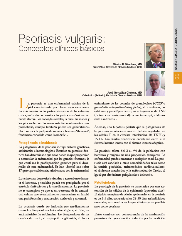 Psoriasis vulgaris: Conceptos clínicos básicos 