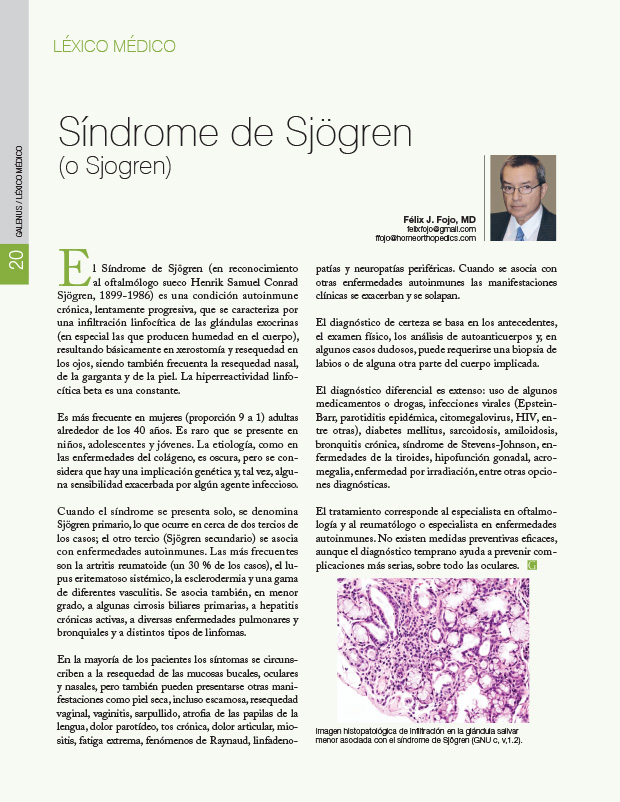 Síndrome de Sjögren (o Sjogren) 