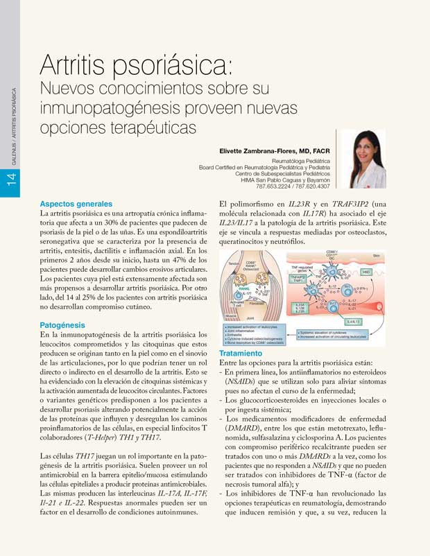 Artritis psoriásica: Nuevos conocimientos sobre su inmunopatogénesis proveen nuevas opciones terapéuticas 