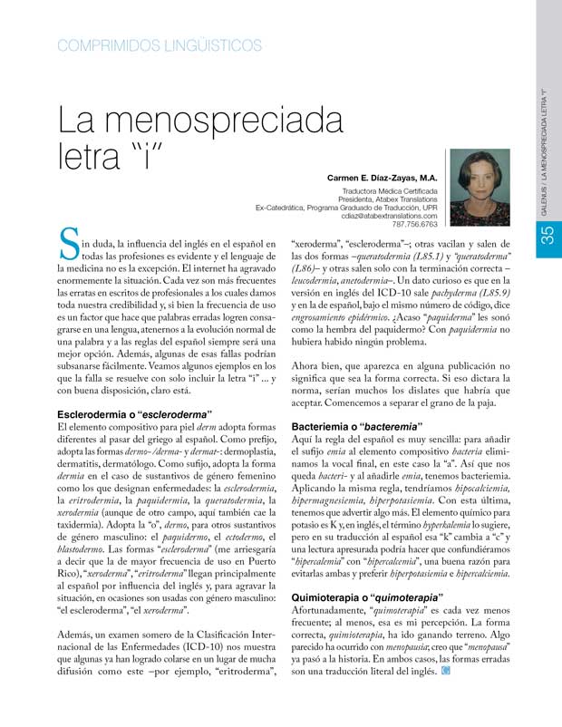 La menospreciada letra “i” 