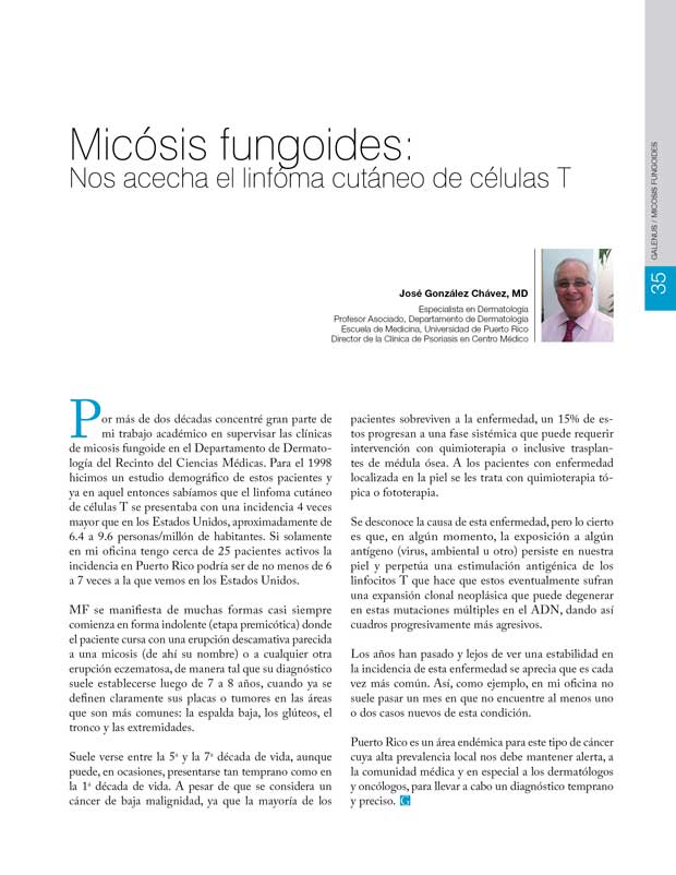Micósis fungoides 