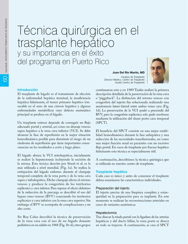 Técnica quirúrgica en el trasplante hepático 