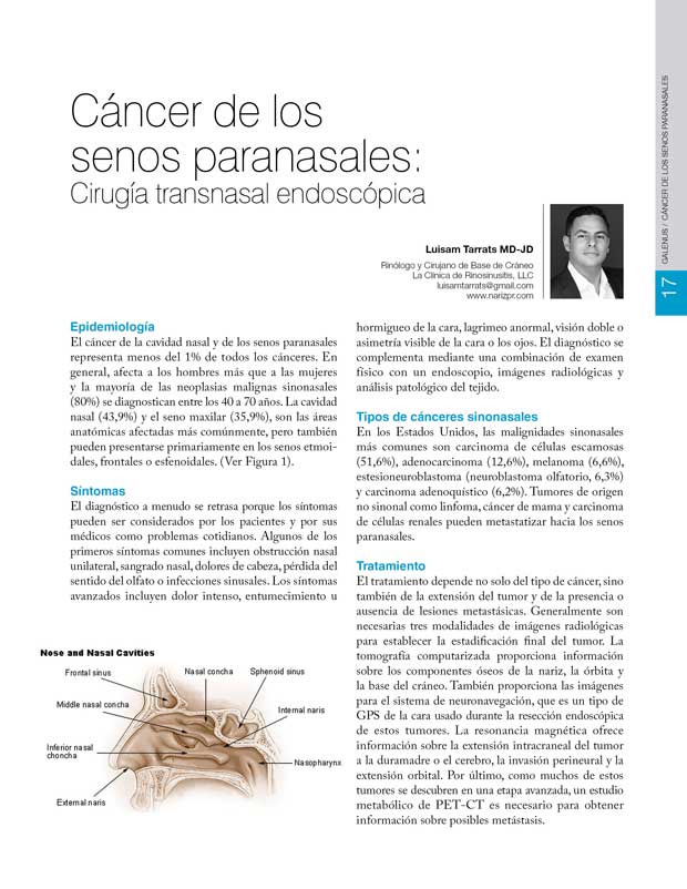 Cáncer de los senos paranasales 