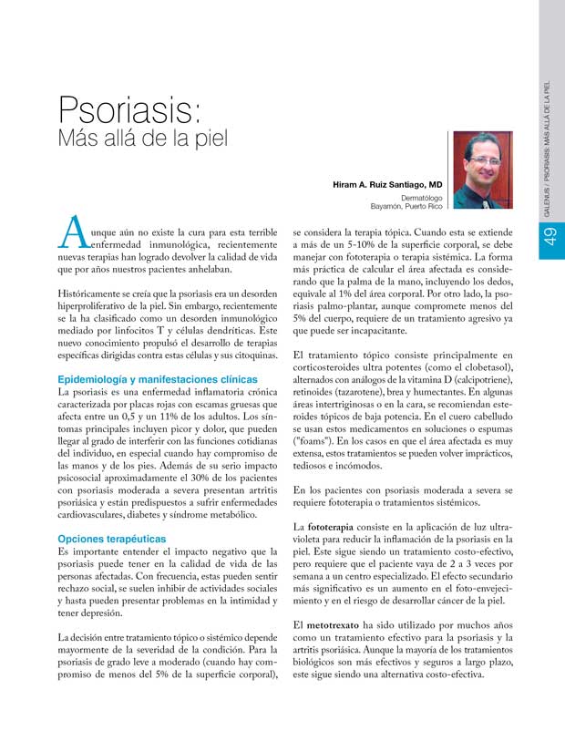 Psoriasis: Más allá de la piel 