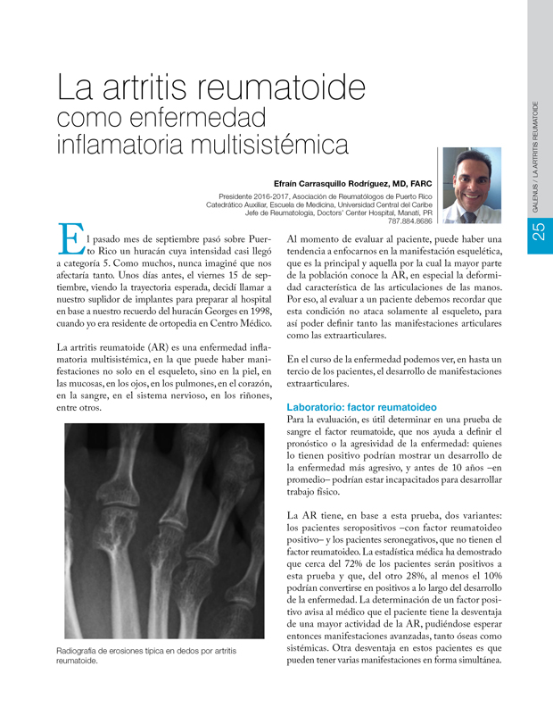 La artritis reumatoide 