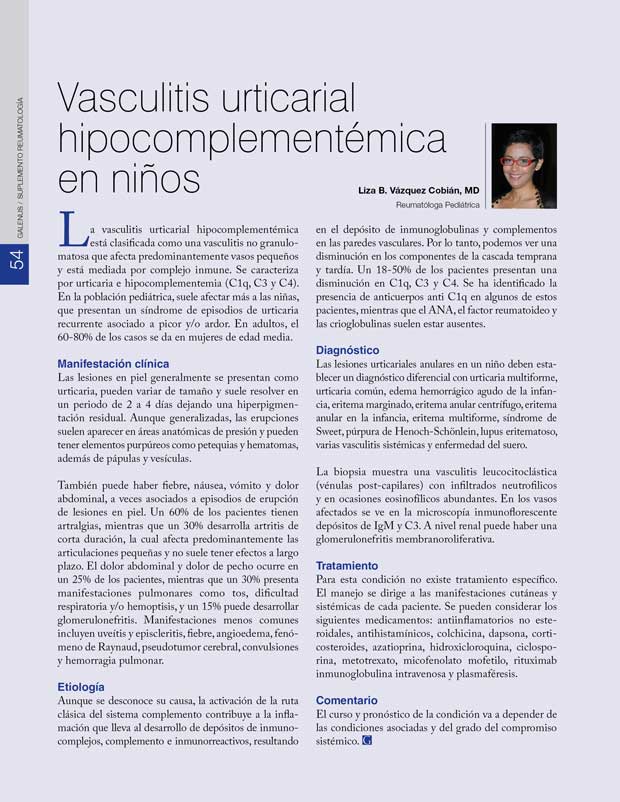 Vasculitis urticarial hipocomplementémica  en niños 
