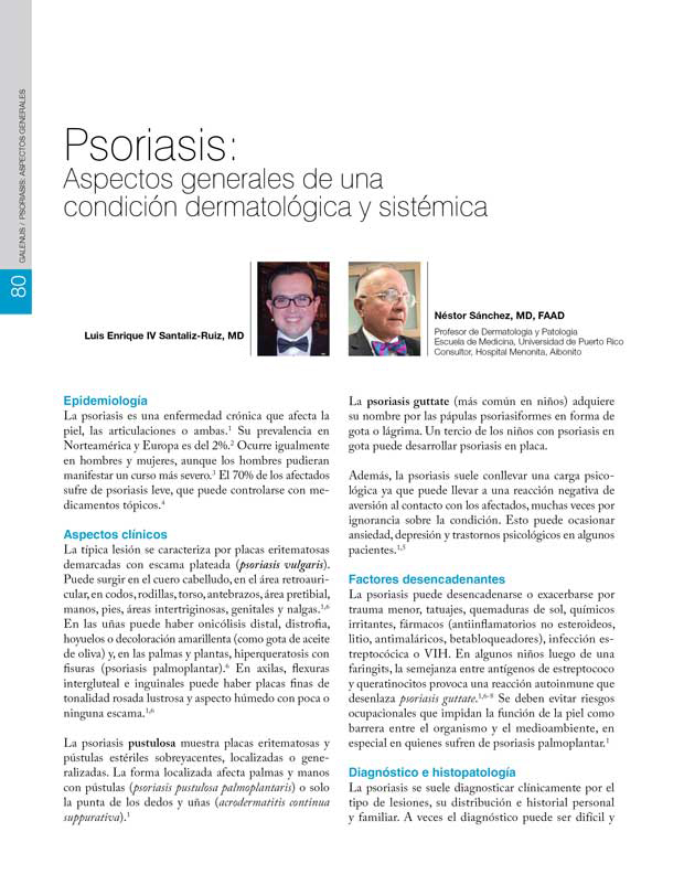 Psoriasis: Aspectos generales 