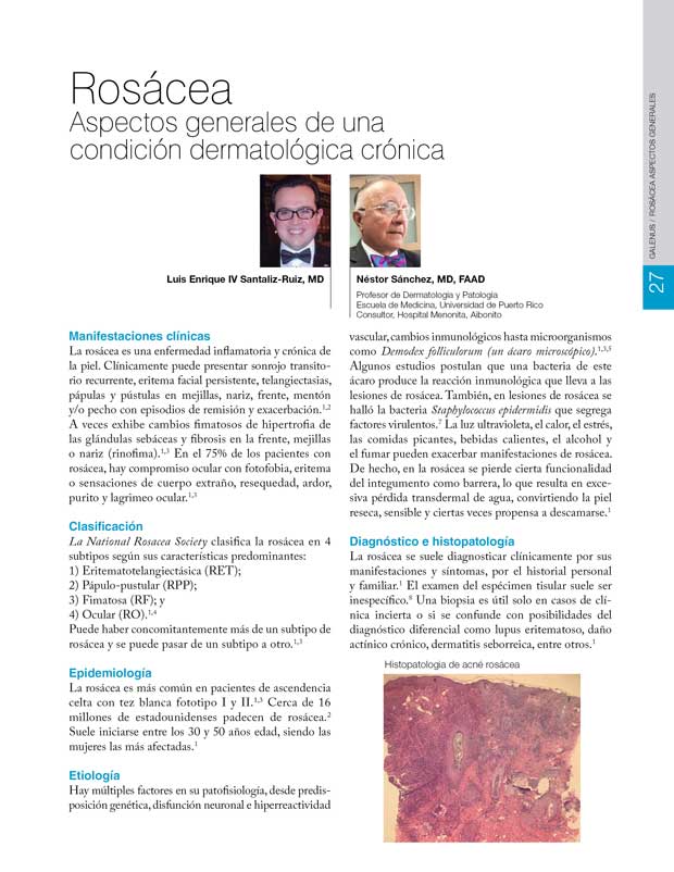 Rosácea Aspectos generales 