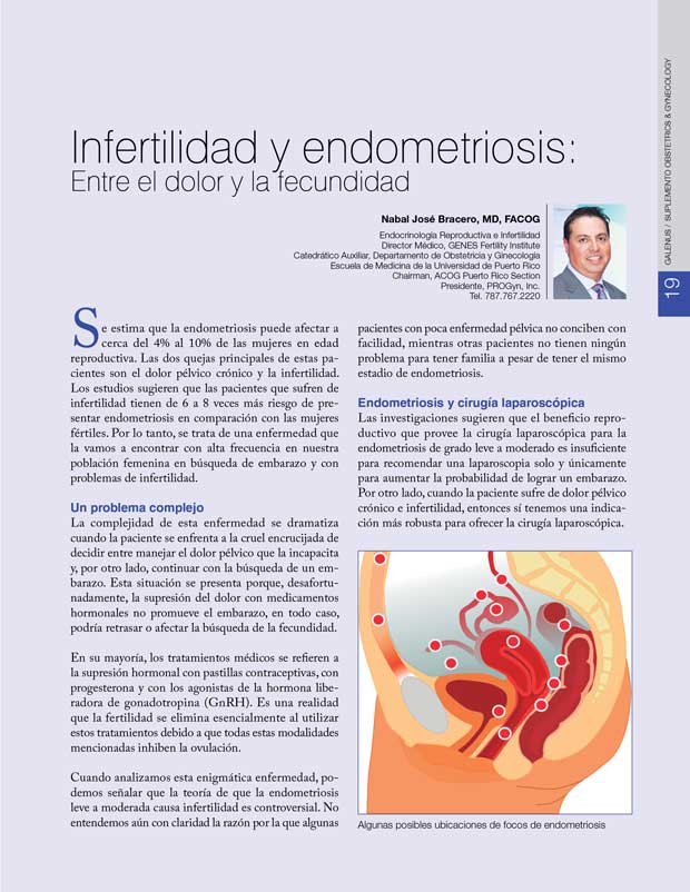 Infertilidad y endometriosis 