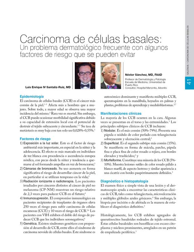 Carcinoma de células basales 