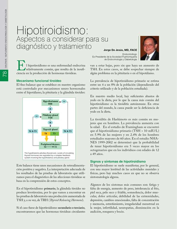 Hipotiroidismo: Aspectos a considerar 
