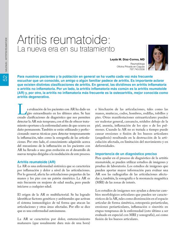 Artritis reumatoide 