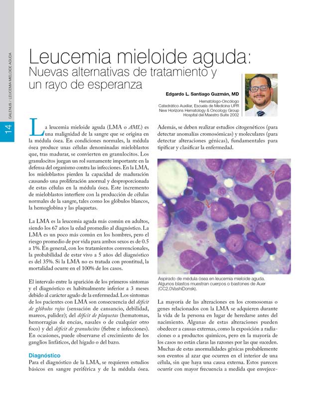 Leucemia mieloide aguda 