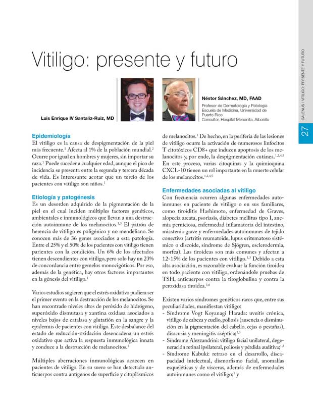 Vitiligo: presente y futuro 